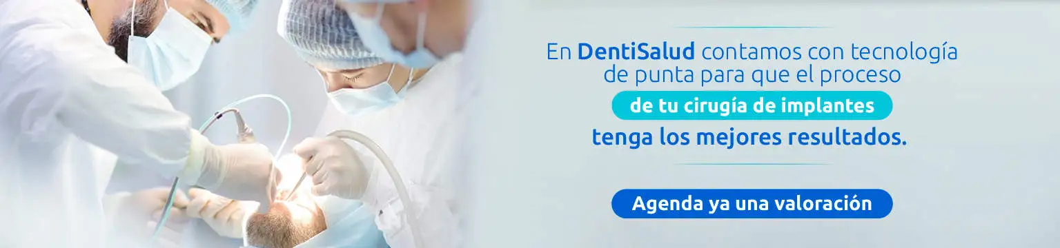 cirugia-guiada-implantes