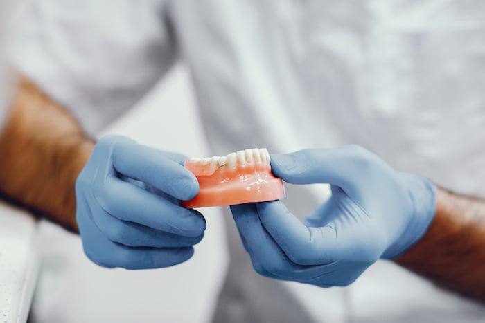 ¿Por qué son necesarias las coronas dentales?