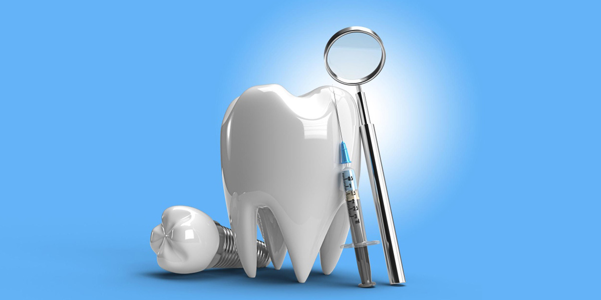 Casos en los que se usan coronas sobre implantes dentales