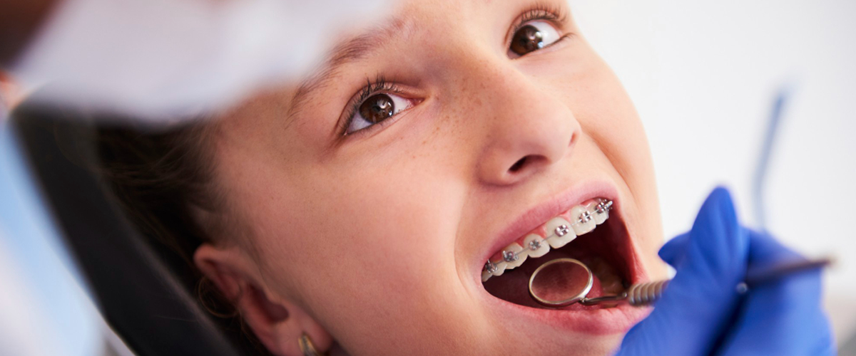 La importancia de la ortodoncia para niños