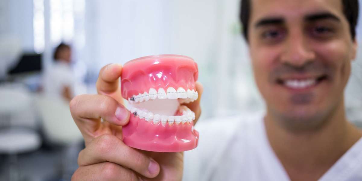 El precio de la ortodoncia de ceramica