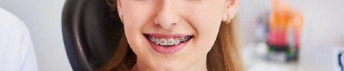 Ortodoncia tradicional con brackets metálicos