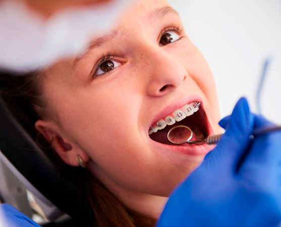 procedimiento-brackets