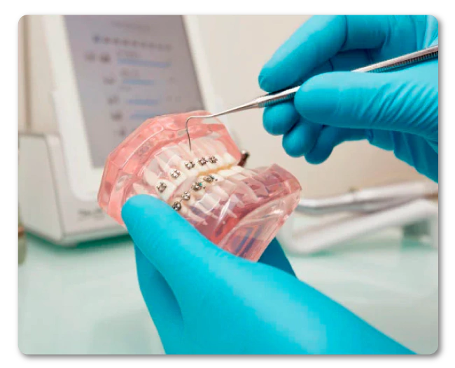El tratamiento de ortodoncia permite solucionar alteraciones bucodentales