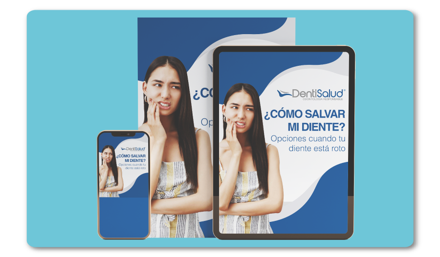 Ebook - Salvar mi diente