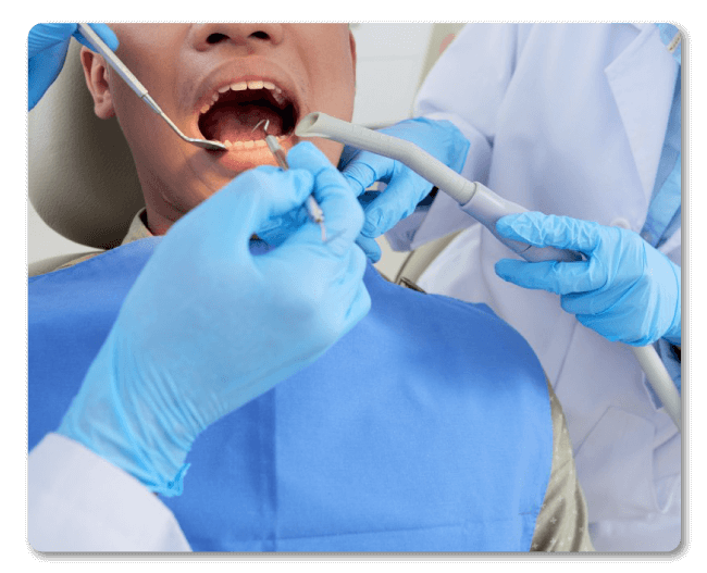 Tipos de endodoncia - Dentisalud