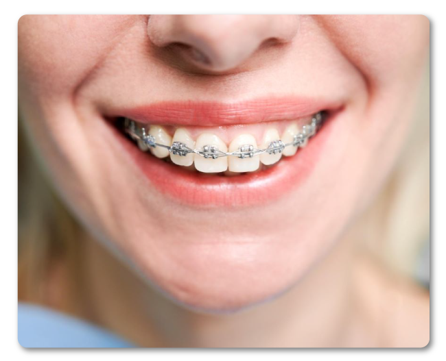 Tratamientos odontologicos en ortodoncia