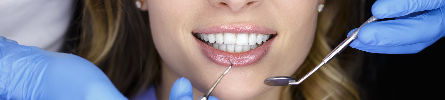 Ventajas de un diseño de sonrisa con resina